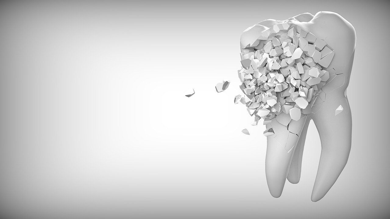 Impianto dentale senza osso: immagina di riavere il tuo sorriso